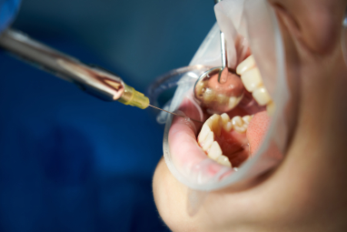 Estética Dental e Restaurações