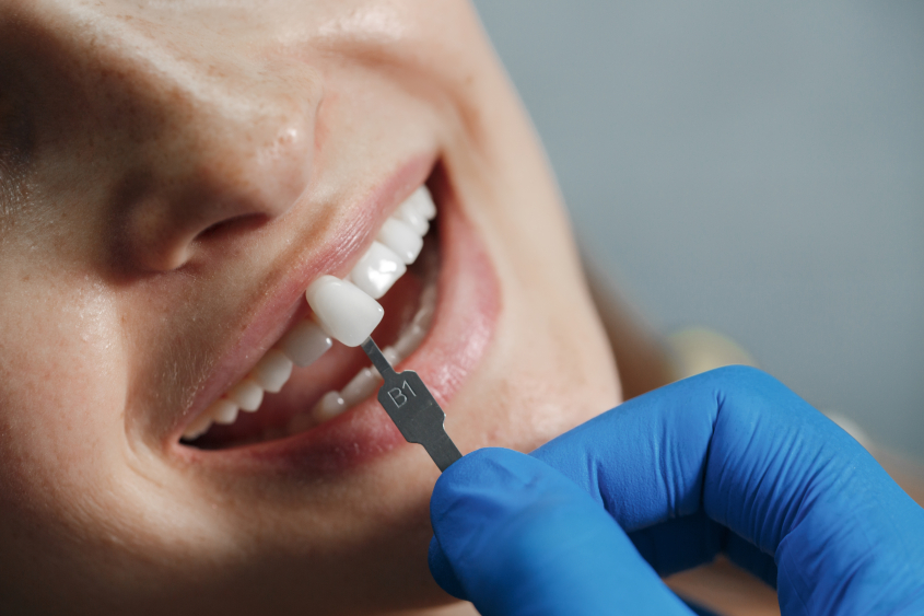 Próteses Dentárias