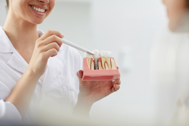 Recupere o Seu Sorriso com Implantes Dentários: Tudo o que Você Precisa Saber
